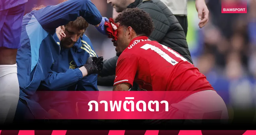 ใจเด็ด! มอร์แกน กิ๊บส์-ไวท์ สังเวยเลือดโชว์แผลเหวอะหน้าผาก ขอบคุณแฟนหลัง ฟอเรสต์ บุกขย้ำ เชลซี