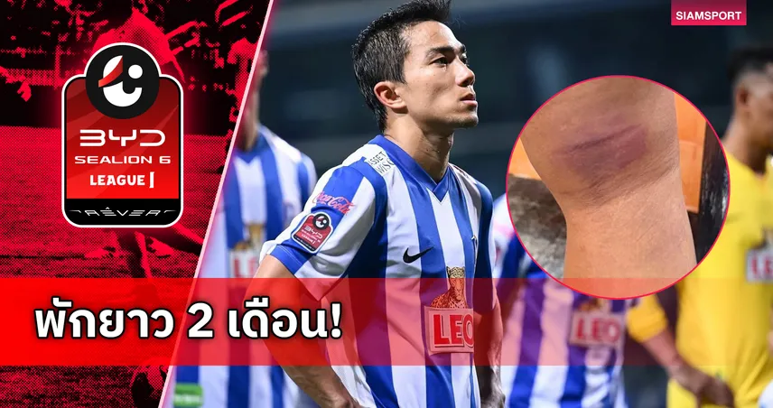 “เจ-ชนาธิป” เจ็บแฮมสตริงพัก 6-8 สัปดาห์ ชวดช่วยบีจีชิงเมืองไทย คัพ