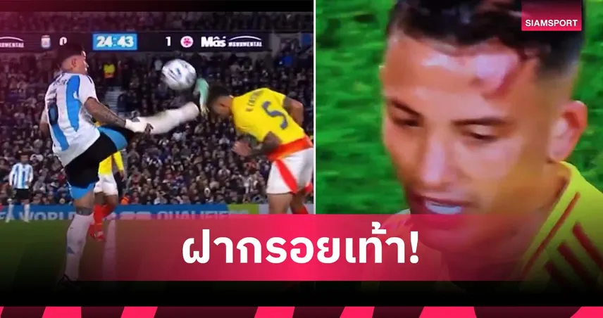 หวาดเสียว! เอ็นโซ่โดนแดง ย่ำหน้าผากแข้งโคลอมเบียแบบเต็มๆ (มีคลิป)