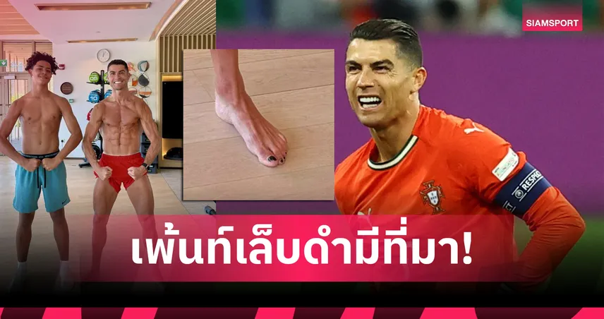 ทำไมโรนัลโด้เพ้นท์เล็บเท้าสีดำ? เผยเหตุผลที่ไม่ใช่แค่แฟชั่น แต่คือเทคนิคระดับนักกีฬาอาชีพ