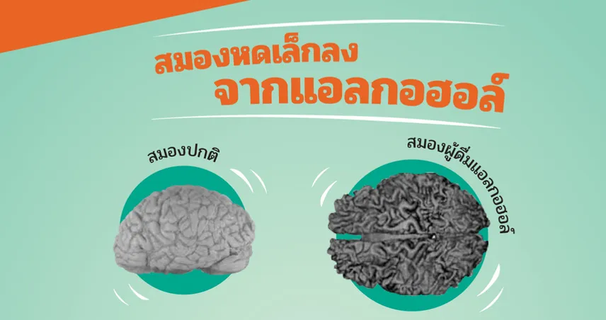 สมองหดเล็กเพราะดื่มแอลกอฮอล์...มีอยู่จริง