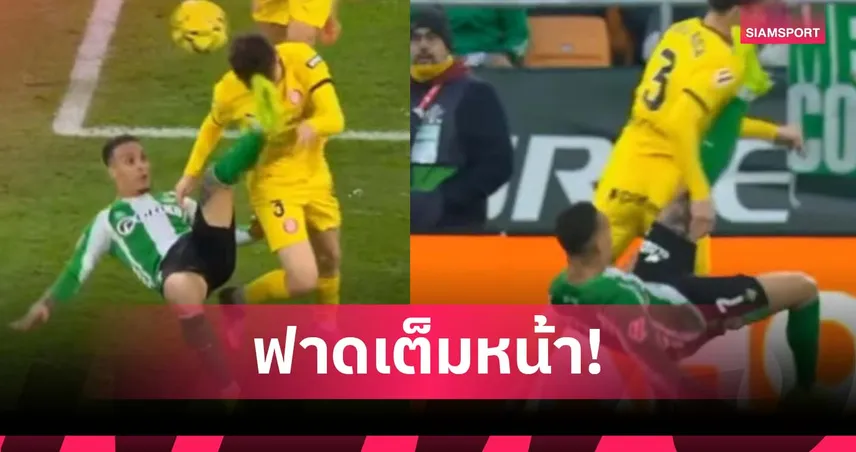 อันโตนี่ โดนแดง! จักรยานอากาศโดนหน้าคู่แข่ง เกม เบติส เสมอ จีโรน่า (มีคลิป)